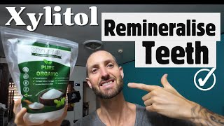 REMINERALISE Your TEETH With XYLITOL  How It Works [upl. by Newkirk]