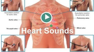 Heart Sounds S1S2S3and others [upl. by Alliscirp]