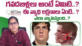 గవదబిళ్లలు అంటే ఏమిటి  Acute Parotitis or Mumps in Telugu  Dr Harika ENT Care Hospital [upl. by Yboc]