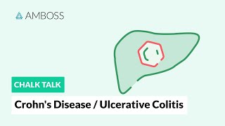 Crohn’s disease and ulcerative colitis Differences [upl. by Gery]