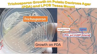 Trichosporon colony morphology on PDA and LPCB Mount Microscopy [upl. by Atnuhs864]