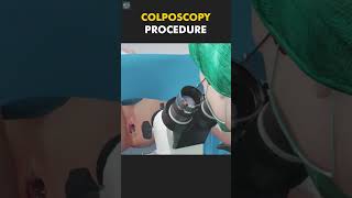 Colposcopy Procedure3D Explained [upl. by Nickolai]