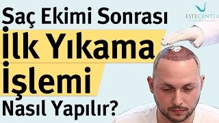 Saç Ekimi Sonrası İlk Yıkama İşlemi Nasıl Yapılır [upl. by Isewk]