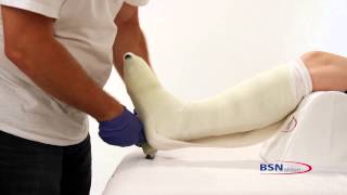 Application technique of Cutimed Total Contact Cast [upl. by Williams]