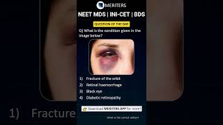 NEET MDS  INICET MDS  PSC  BDS  Most Important Questions neetmds2025 mdsprep [upl. by Idahs763]