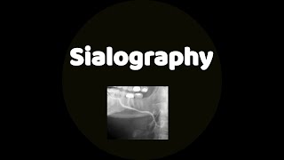 Sialography [upl. by Rocky]