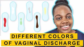 VAGINAL DISCHARGE What Every Woman NEEDS to Know [upl. by Enovahs377]