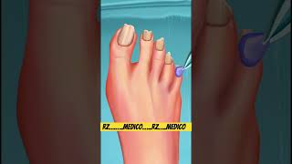 Treatment of nail infection nail treatment pedicure nailtreatment shorts [upl. by Anaz]