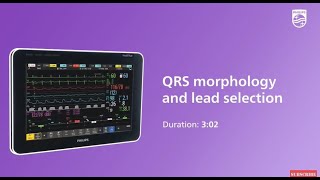 QRS morphology and lead selection at the IntelliVue patient monitor [upl. by Iraam446]