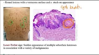 USMLE ACE Video 192 Skin Disorders Overview [upl. by Renrew]