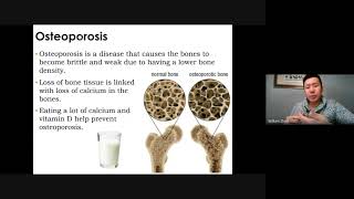 Science 10 SNC2D Musculoskeletal and Nervous System [upl. by Iblehs]