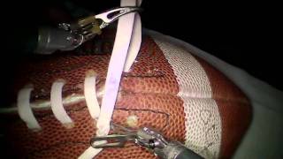 Seattle Doctor Laces Football Using da Vinci Robot [upl. by Crista541]