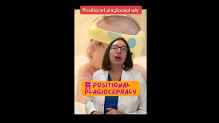 Positional Plagiocephaly Pediatrics SHORT  LevelUpRN [upl. by Russian]