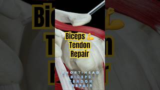 Biceps 💪 tendon repair  usmle Review [upl. by Ivette]