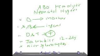 QUICK PEDIATRICS Criteria to diagnose ABO incompatibility [upl. by Ylrahc]