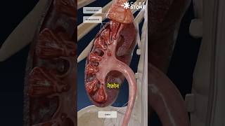 How kidney stones are removed  RIRS  How urine is formed  Laser treatment shorts [upl. by Anada]