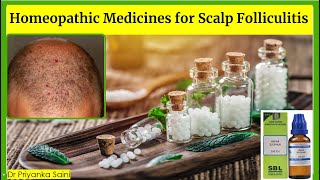 Homeopathy treatment for Scalp Folliculitis  red bump  itching  sensitive Dr Priyanka Saini [upl. by Mayhs]