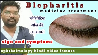 blepharitis treatment  blepharitis  treatment of blepharitis  blepharitis  hindiophthalmology [upl. by Yci]