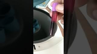 Centrifuge machine plasma separation of blood [upl. by Erick559]