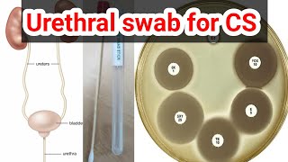 urethral swab for culture and sensitivity CS test urduhindi [upl. by Nnylarat]