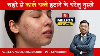 Black spots on skin and its natural remedies  Dr Bimal Chhajer  SAAOL [upl. by Fidelity205]