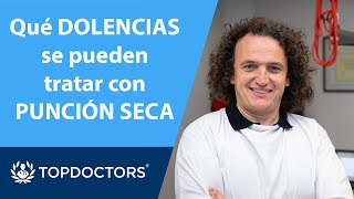 Dolencias que pueden tratarse con PUNCIÓN SECA  José Santos SánchezFerrer  Top Doctors 34 [upl. by Kulseth]