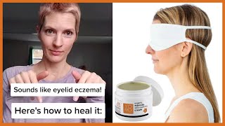 How to Heal Your Eyelid Eczema Naturally [upl. by Clarke]