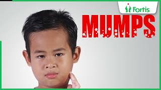 Learn about Mumps Symptoms Causes and Treatments with Dr Neetu Talwar [upl. by Alemat]