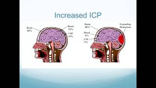 Altered Neurologic Function [upl. by Tova]