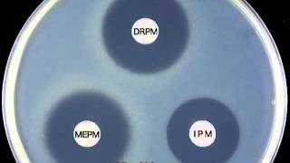 CARBAPENEMS  Doripenem Mechanism of Action [upl. by Cassie888]