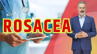 Rosacea  Comprehensive Guide to Managing Symptoms and Skin Care [upl. by Anse325]