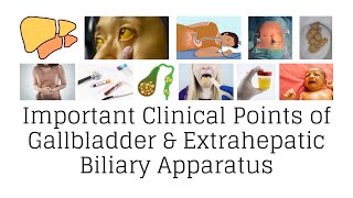 Clinical anatomy of gallbladder and extrahepatic biliary apparatus gallbladder clinicalanatomy [upl. by Dyna]