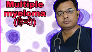 Multiple myeloma Blood cancer type symptoms treatmentरक्त कैंसरDoctor on YouTube Hindi [upl. by Anitnegra553]