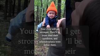 Your child may have Achondroplasia littleperson achondroplasia dwarfism [upl. by Messab]