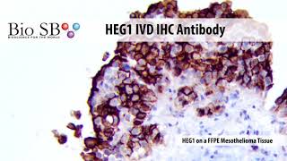 Bio SB  2021 New HEG1 Antibody for IHC [upl. by Doubler]