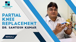 Partial Knee Replacement  By Dr Santosh Kumar Kolkata  in Bengali [upl. by Cowan900]