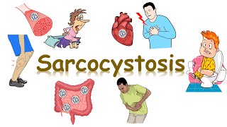 شرح Sarcosporidiosis sarcocystis [upl. by Mota]