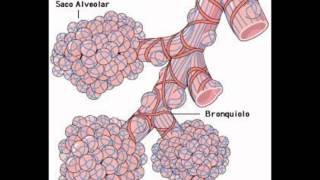 Crepitantes finos con sonido bronquial lob derecho medio [upl. by Sihtnyc]