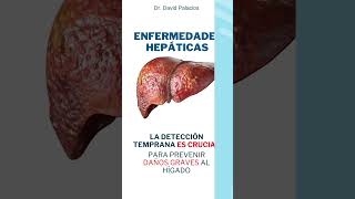 Enfermedades del Hígado HEPATICAS [upl. by Rawdin]