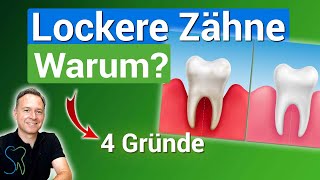 Zähne Locker Warum 4 Gründe und was du dagegen tun kannst [upl. by Lissak]