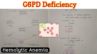 Glucose 6 Phosphate Dehydrogenase G6PD Deficiency  Hemolytic Anemia [upl. by Ardnaiek722]