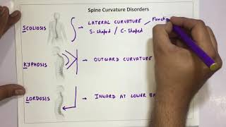 Spine Curvature Disorders  Scoliosis Kyphosis Lordosis [upl. by Nahtanaj954]