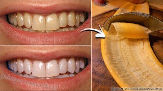 Secret that Dentists dont want you to know Remove Tartar and Teeth Whitening in just 2 minutes🪥🦷 [upl. by Rosalia471]