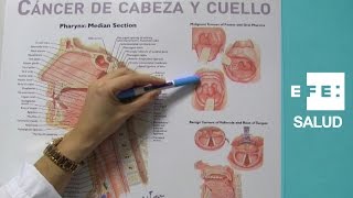 Cáncer en la boca por infecciones tabaco y alcohol [upl. by Aokek]