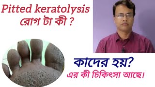 Pitted keratolysis রোগ টা কী  clinicalpatsala [upl. by Tarryn]