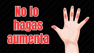 ENTUMECIMIENTO 3 cosas que debes saber [upl. by Wight]