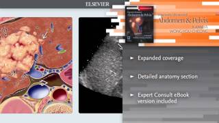 Diagnostic Ultrasound Abdomen and Pelvis [upl. by Ramey40]