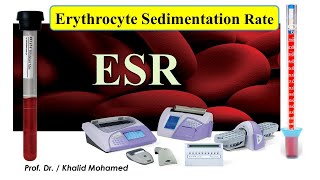 Erythrocyte Sedimentation rate what is new Automation اختبار سرعة الترسيب [upl. by Yracaz]