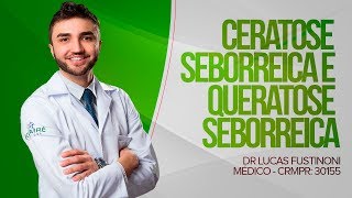 Tudo sobre Ceratose Seborreica e Queratose Seborreica  Dr Lucas Fustinoni  Médico  CRMPR 30155 [upl. by Grondin]