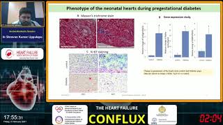 HFAI Conflux 2021 Day 1  Invited Abstracts session by Dr Shravan Kumar Uppulapu hfai​ [upl. by Yejus]